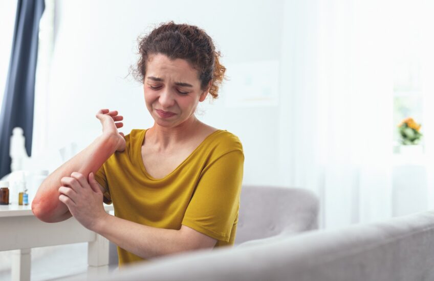 Woman with eczema scratching her arm and wincing in pain.