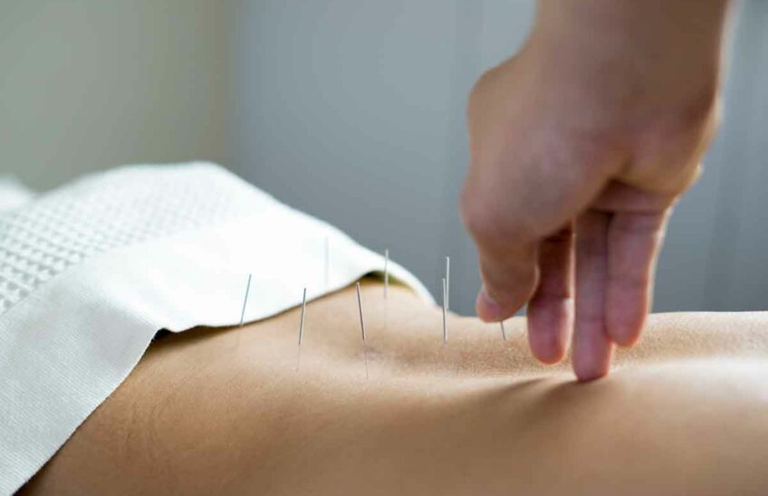 An acupuncturist giving treatment to a patient