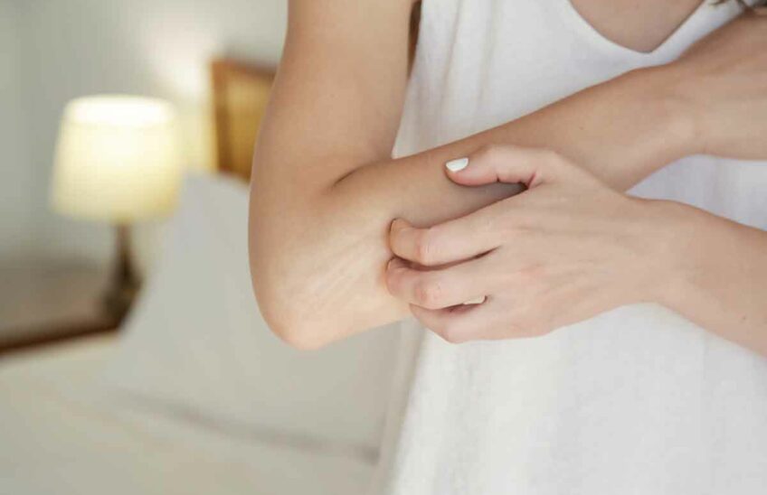 A person scratching a dry, itchy elbow